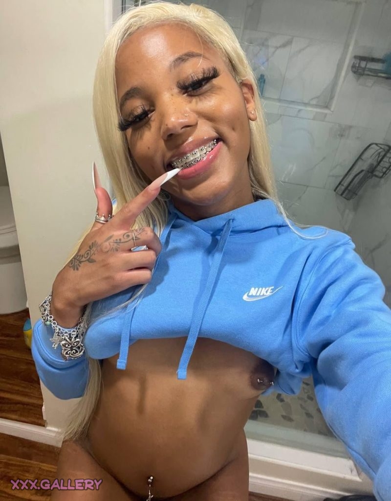 Brace Yourself The Truth About Braces