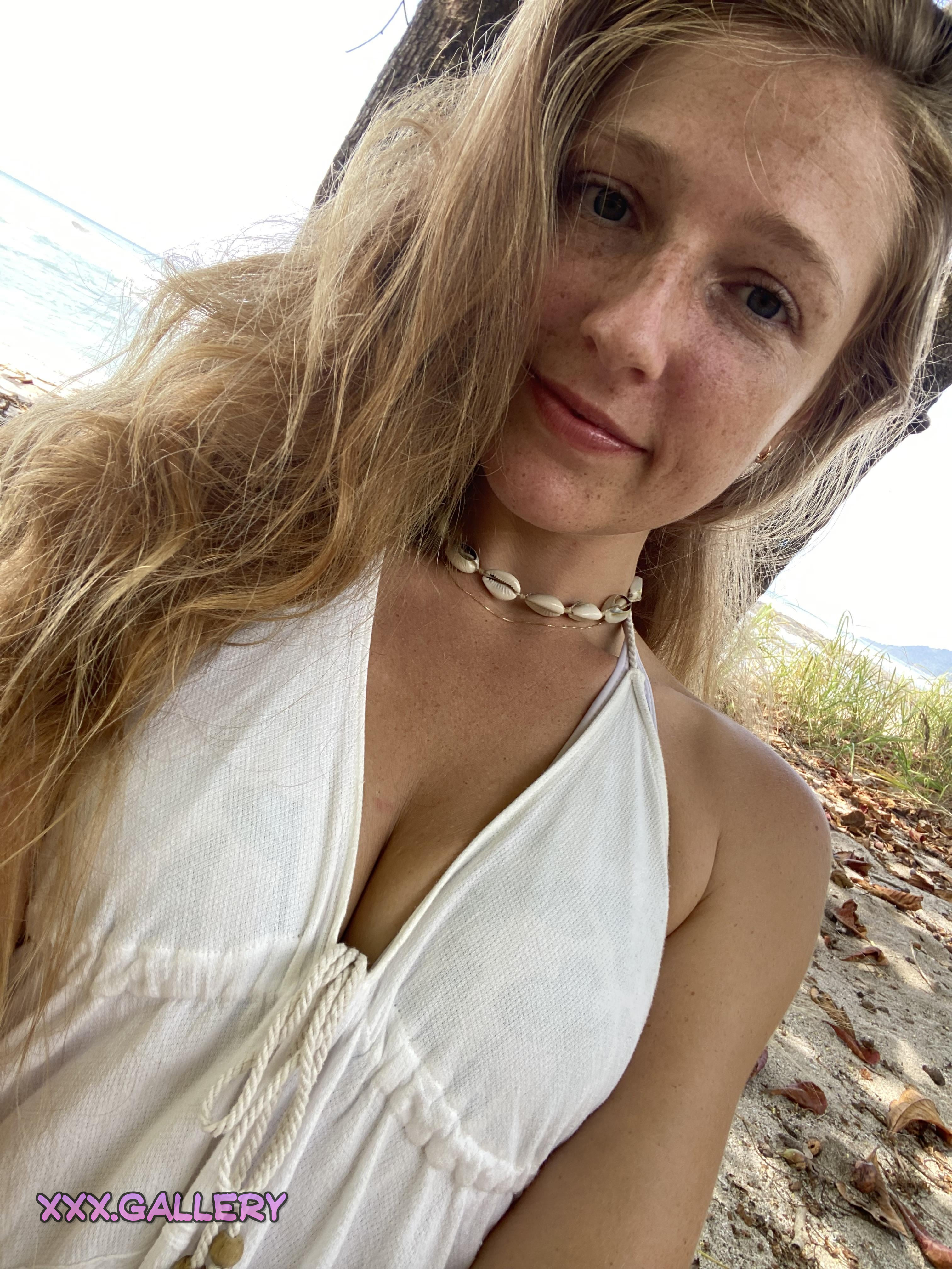 Sizzling Sun-Kissed Freckles ☀️