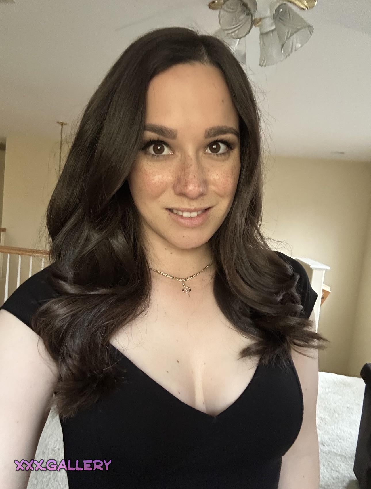 Freckled Goddess: A Triple Dose of Irresistible Charm 🌹💋