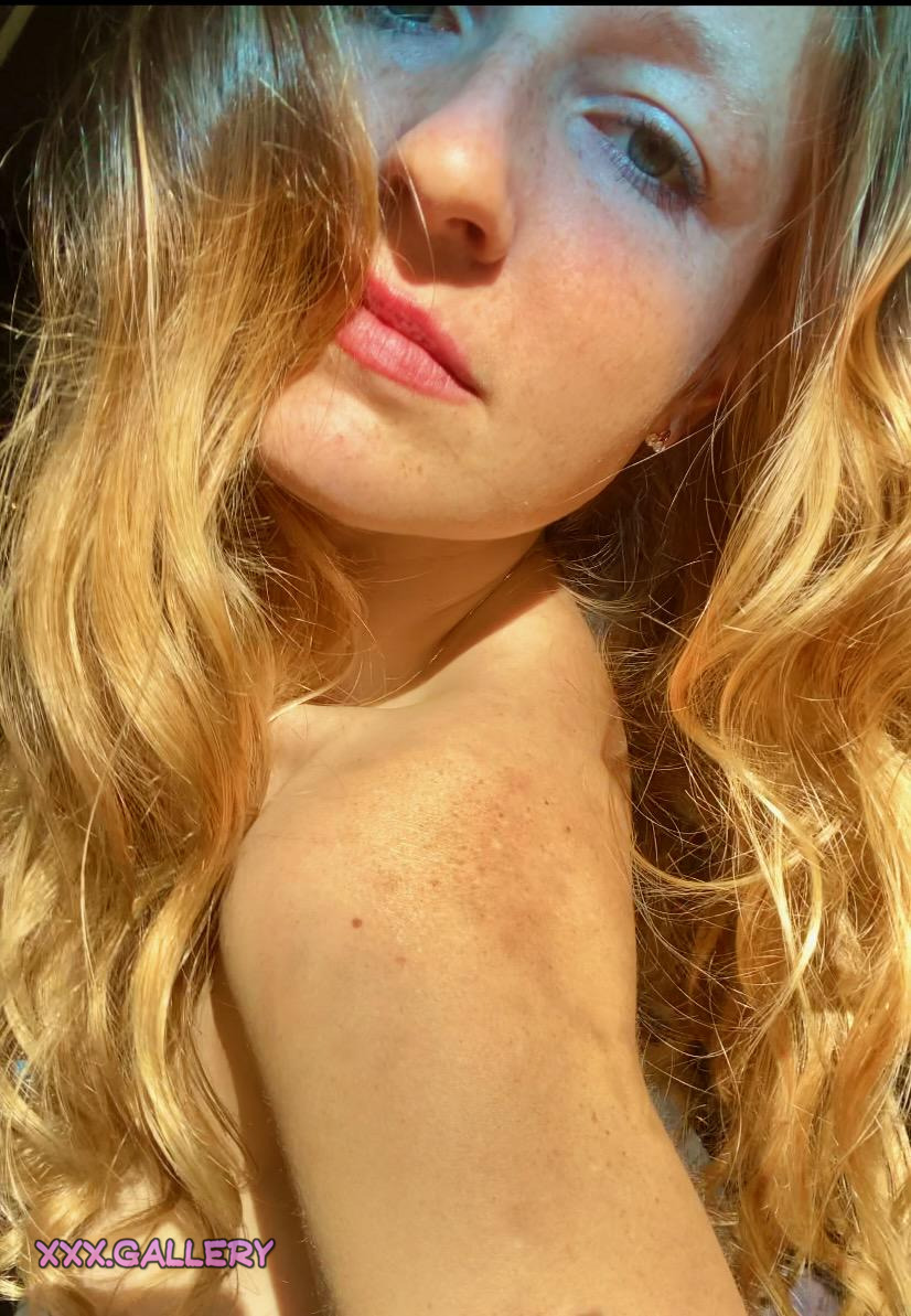 Freckles: Do You Prefer More or Less?