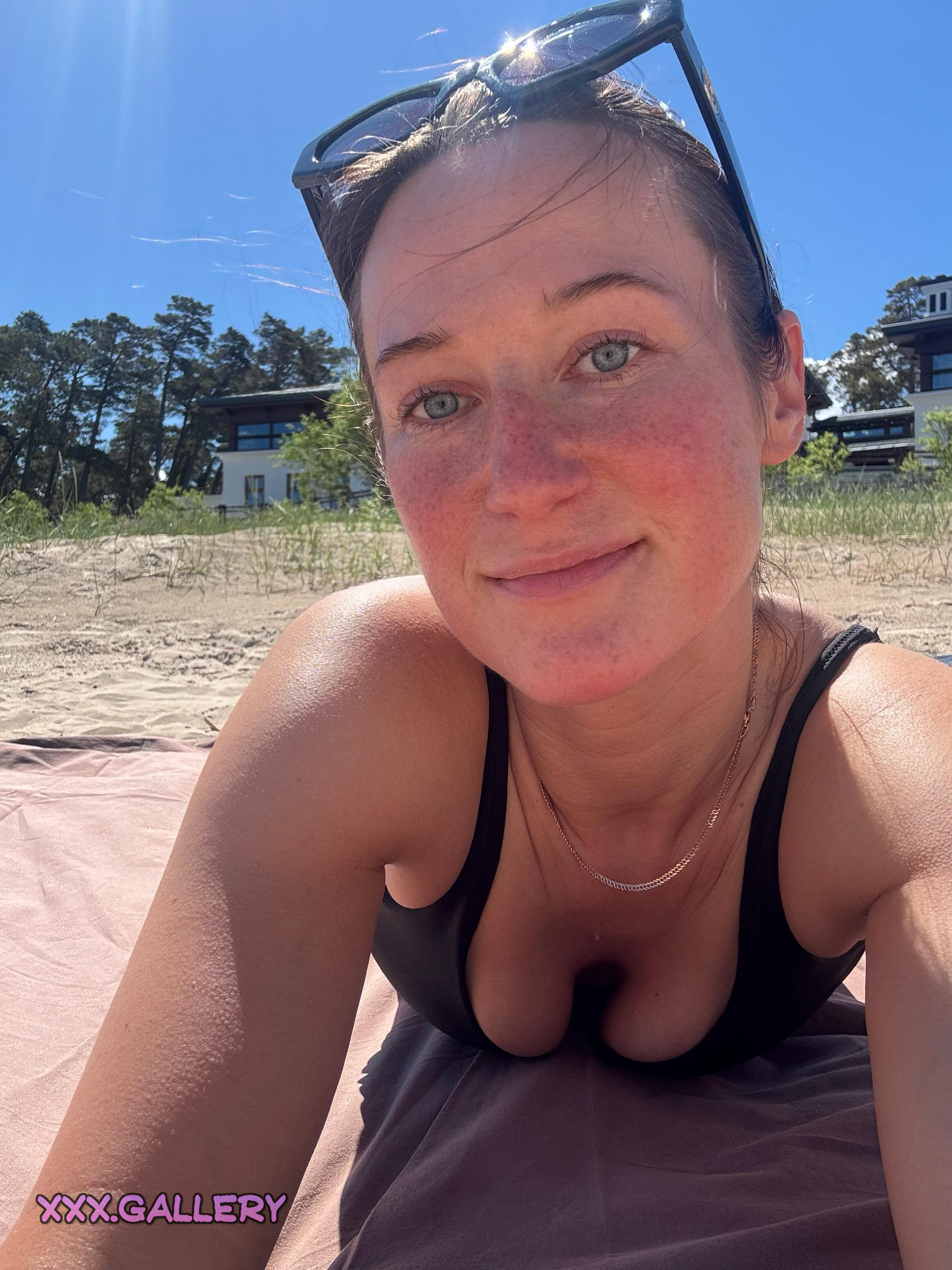 Freckles Galore: Your Skin Glimmering with Adorable Blemishes!